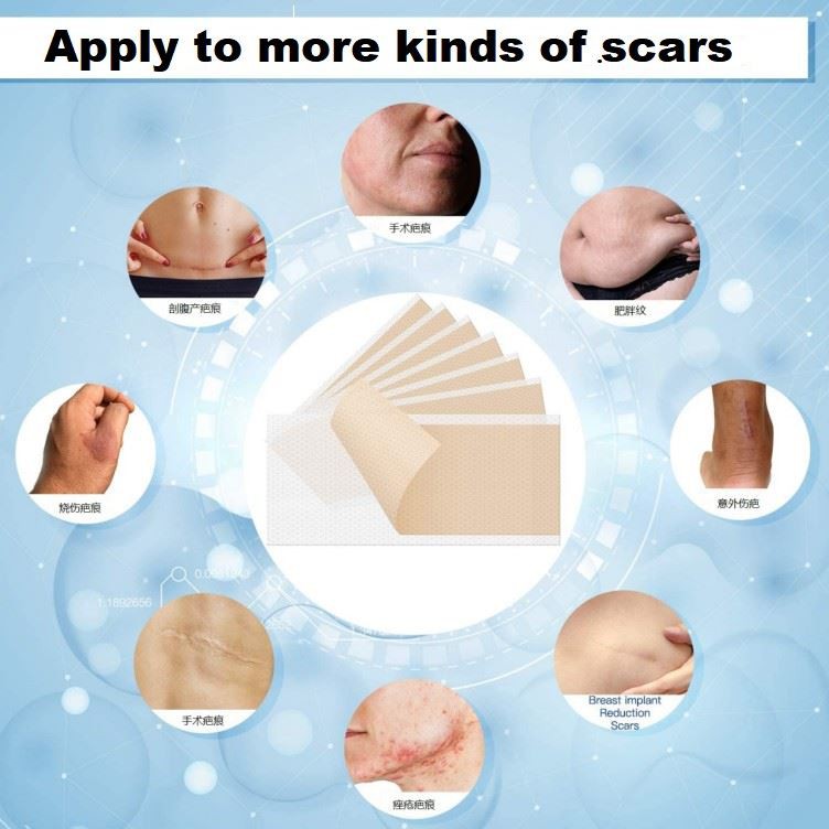 silicone gel pads silicone gel pads