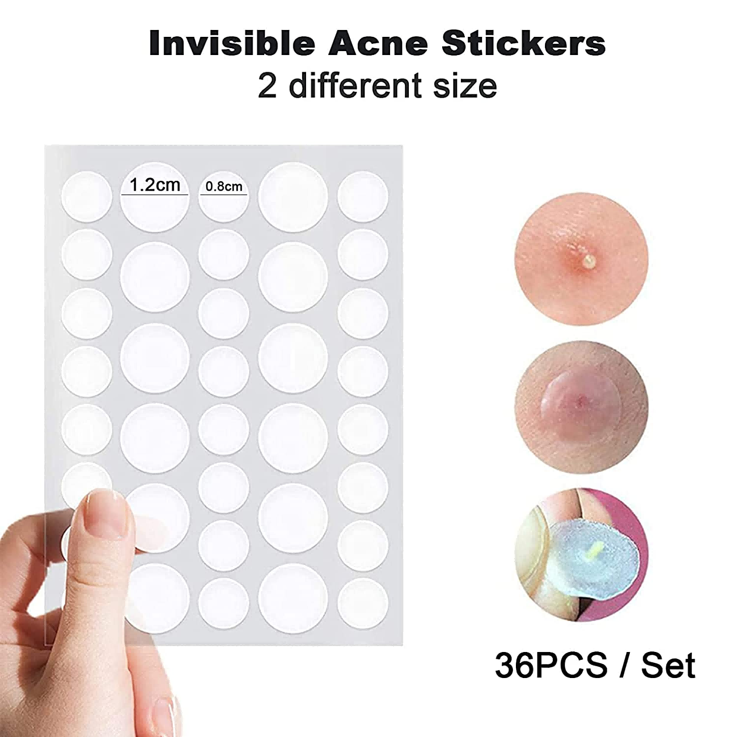 Salicylic acid acne pimple patch