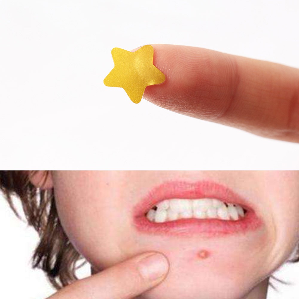 hydrocolloid acne pimple patch spots hydrocolloid acne pimple patch spots